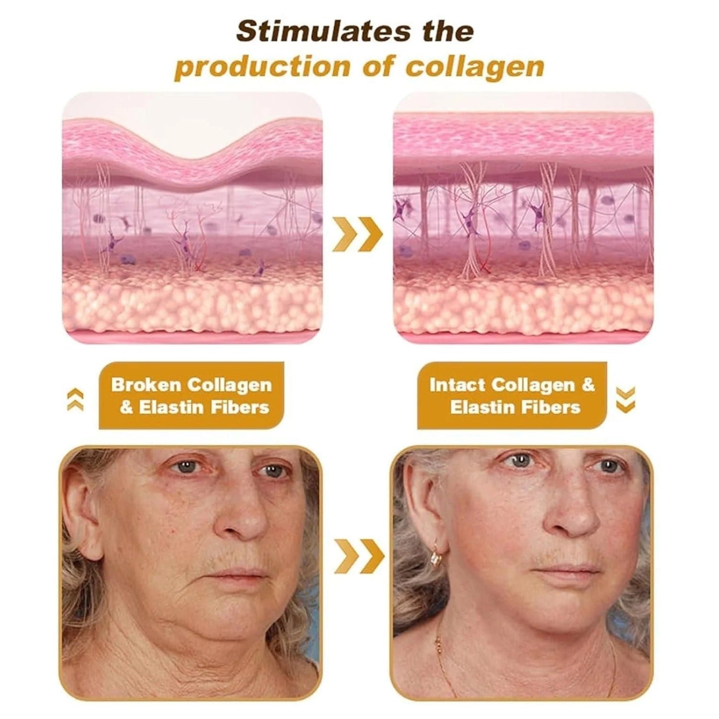 (Buy 1 Get 1 Free) Bee Venom Botox Wrinkle Repair Cream